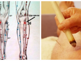 Точка долголетия от ста болезней (Цзу-сан-ли, Е 36)