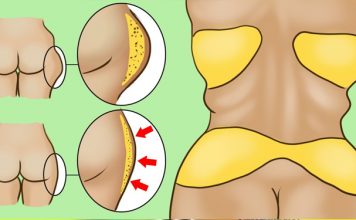 Как вернуть фигуру после 35