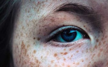 Я — дерматолог. И я знаю только 1 способ избавиться от коричневых пятен на коже