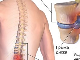 Хирург отговорил меня от операции