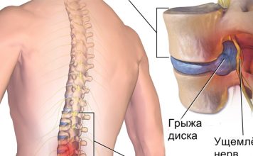 Хирург отговорил меня от операции