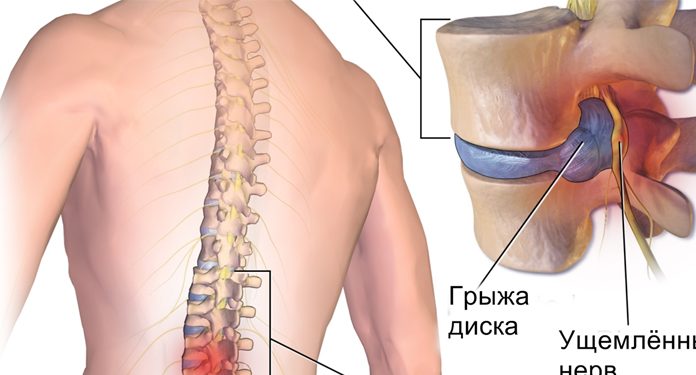 Хирург отговорил меня от операции