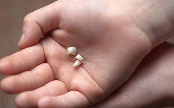 молочные зубы