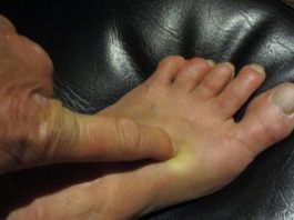 Особая точка на ноге избавит вас от бессонницы — чудеса акупунктуры точка на ноге от бессонницы