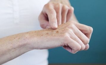 Попрощайтесь с пятнами, морщинами, веснушками и бородавками