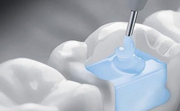 Ученые изобрели вечную пломбу, которая сама будет лечить зуб!