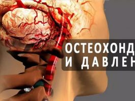 Шейный остеохондроз и высокое давление как неразлучная парочка