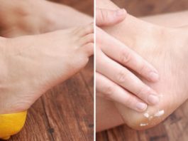Лимон для пяток