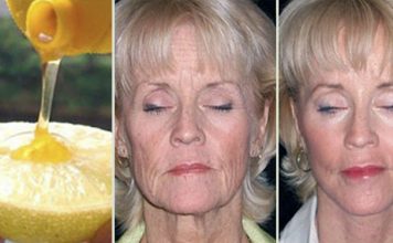Как выглядеть на 10 лет моложе с лимоном и медом