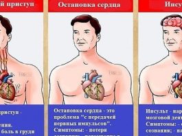 Это может спасти вам жизнь: разница между инфарктом, инсультом и остановкой сердца Разница между инфарктом и инсультом