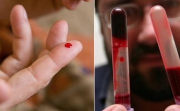 Кардиолог: «Эти 7 продуктов разжижают густую кровь, обязательно включите их в рацион!»