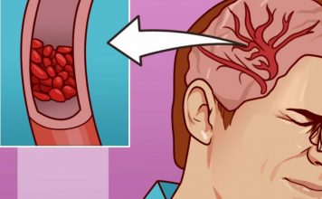 12 предупреждающих знаков низкого уровня магния в организме