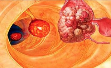 99% болезней, включая рак, можно было бы избежать, если бы люди знали об этом…