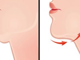 7 способов борьбы со вторым подбородком