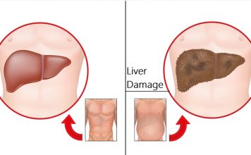 Повреждение печени