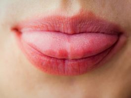 недостаток витамина B12