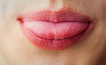 недостаток витамина B12