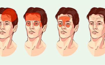 Гид по головной боли